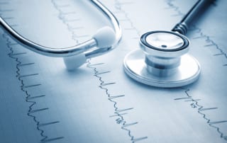 stethoscope resting on an EKG